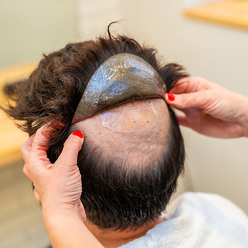 A hair tech is fixing a hair piece (wig) to the top of a client's head.