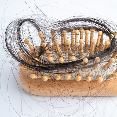 Hair Restoration FAQ's. A closeup of a hair brush full of loose hair.