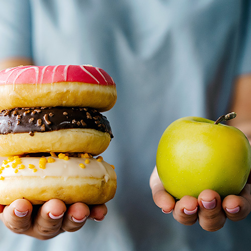 Hair Loss From Diet. A person holds donuts in one hand and an apple in the other.