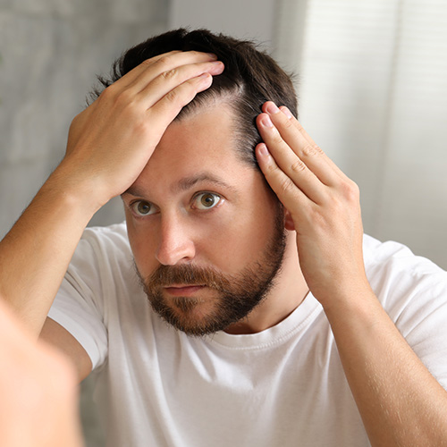 Hair Restoration For Men. A man looks into a mirror and examines his thinning hair.