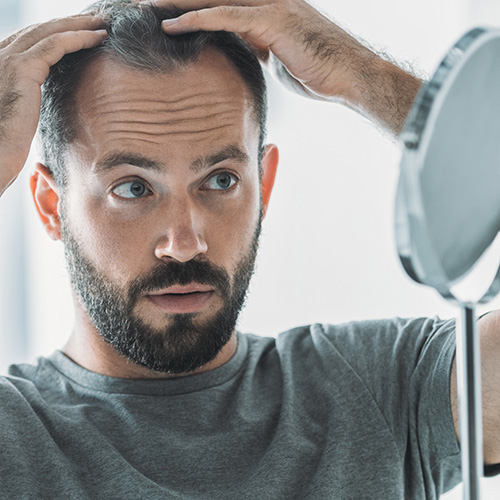Hair Loss From Age. A man parts his hair and looks at his thinning hairline.